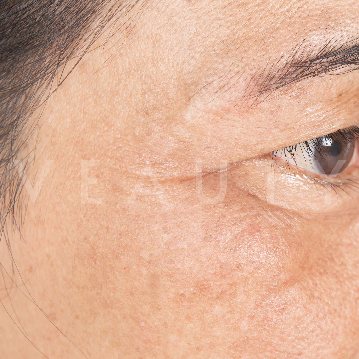 image comparison after