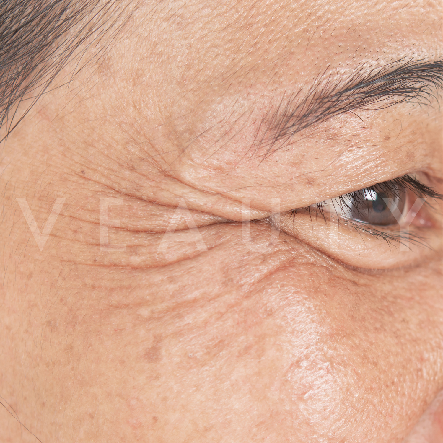 image comparison before